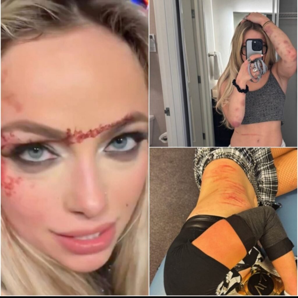 Rhea Ripley injures Liv Morgan’s arm in a vicious steel chair Attack
