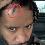 Main Event Jey Uso had to get stitches after accidently busting himself open at WrestlePalooza