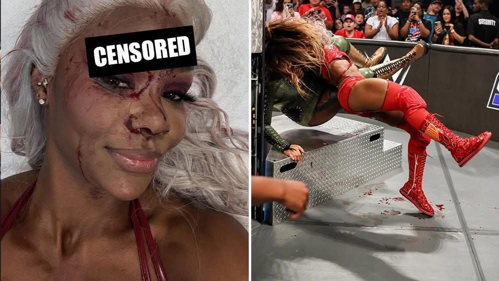 Jade Cargill shows graphic images of nasty gash suffered from Nia Jax spot on SmackDown