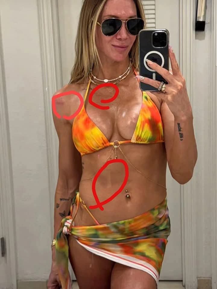 Mysterious Marks on Charlotte Flair’s Body Spark Speculation — Fans Wonder: Accident or Something More?”