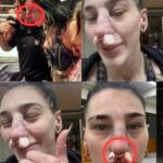 Rhea Ripley was sadly escorted out by WWE medical staff after being inadvertently busted open when Raquel threw Iyo Sky into her.